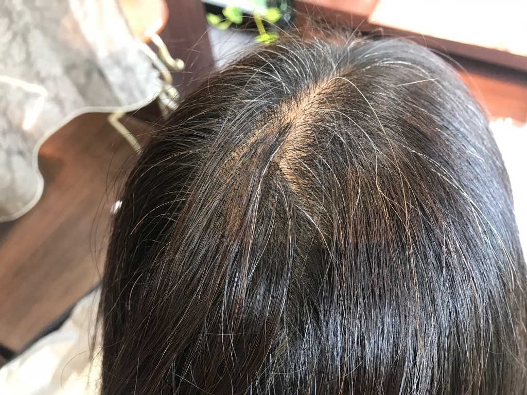 白髪のかたまり撃退方法 神戸で人気の美容院パシフィックダズール公式webサイト 西区 垂水区 白髪のかたまり撃退方法 神戸で人気の美容院パシフィックダズール公式webサイト 西区 垂水区